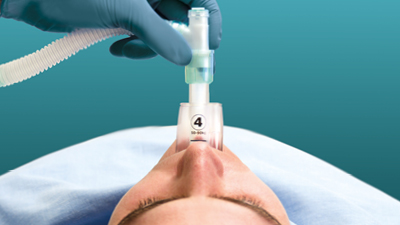 Gestione delle Vie Aeree