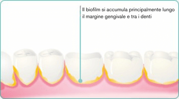 ITA-explore-image-oral-care-vap-facts-2