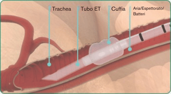 ITA-explore-image-oral-care-vap-facts-3
