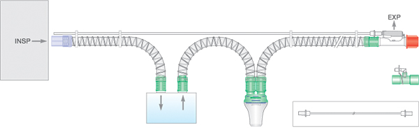 Circuito per ventilazione Smoothbore da 22mm con kit per linea di monitoraggio della pressione, ampolla raccogli condensa, spezzone da 0.4m, 1.6m
